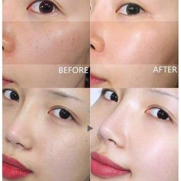 [10pcs] DONGSUNG RANNCE Creams Mini 10g UV improving freckles blemish Korean Beauty Cosmetics Womens Skincare whitening effect